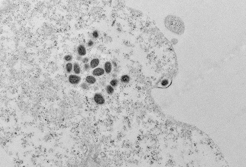 Brasil registra 140 casos confirmados de mpox em 2026, aponta Ministério da Saúde